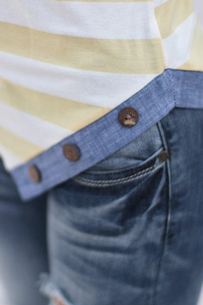 Yellow Striped Top with Buttons